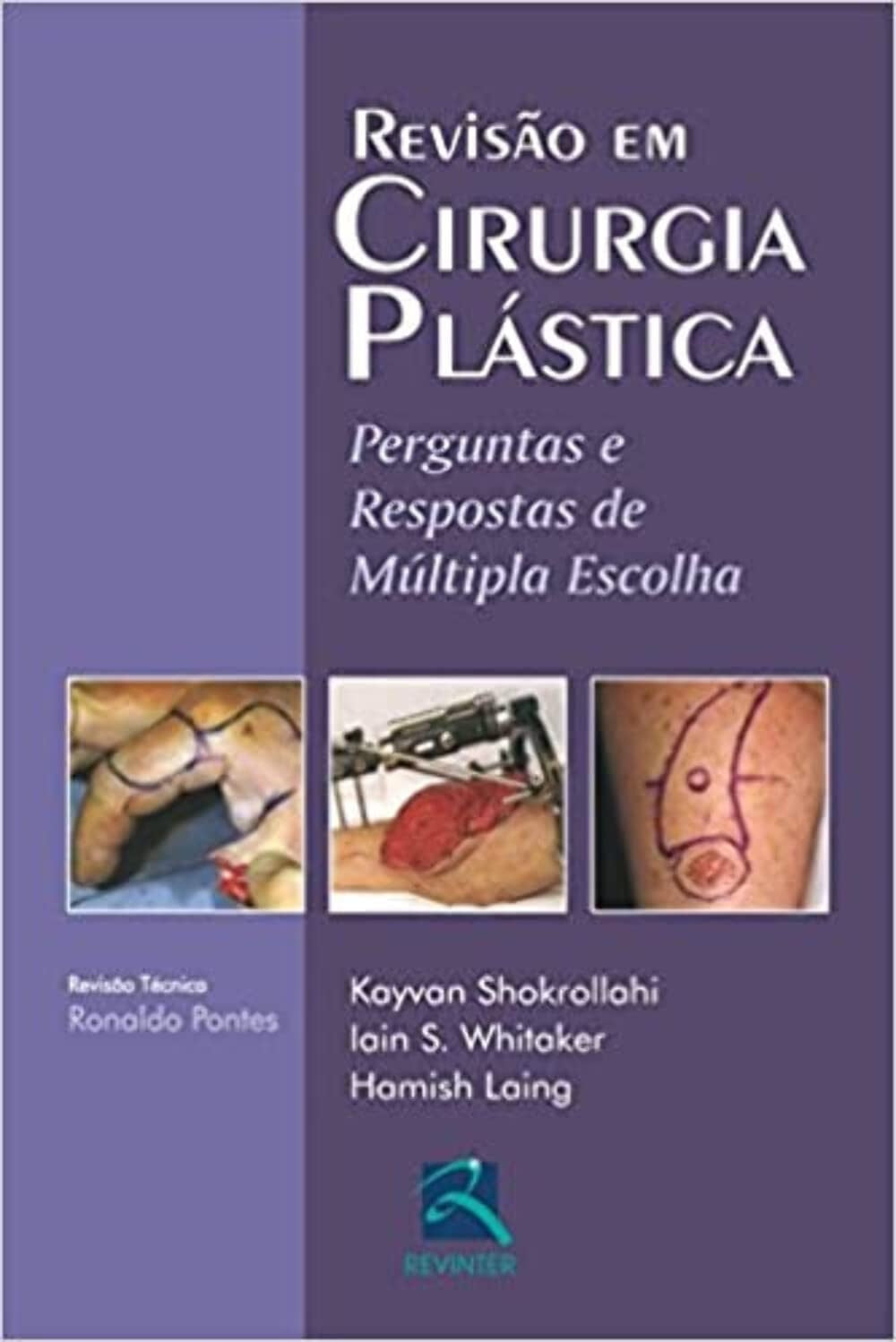 Revisão em Cirurgia Plástica: Perguntas e Respostas de Múltipla Escolha