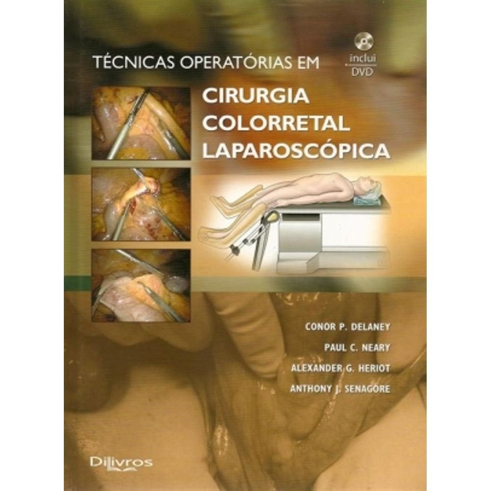 Tecnicas Operatorias em Cirurgia Colorretal